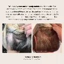 REAL HAIR GROWTH USING AWAKEN.webp