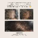 HAIR GROWTH TESTIMONY.webp